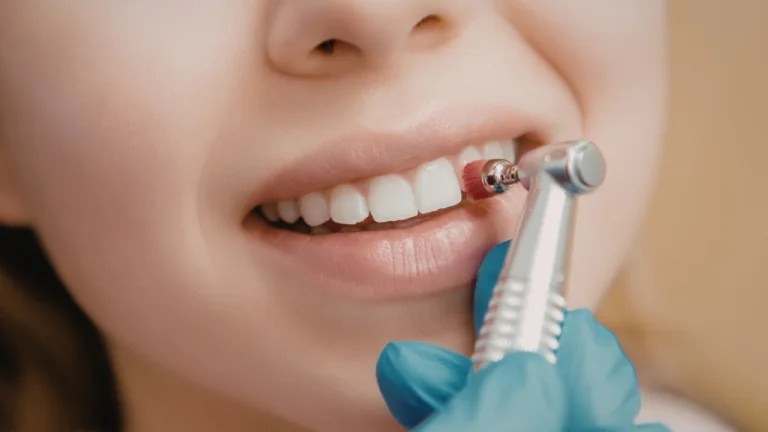 Teeth Whitening: What Works, What Does Not, and What It Cannot Touch