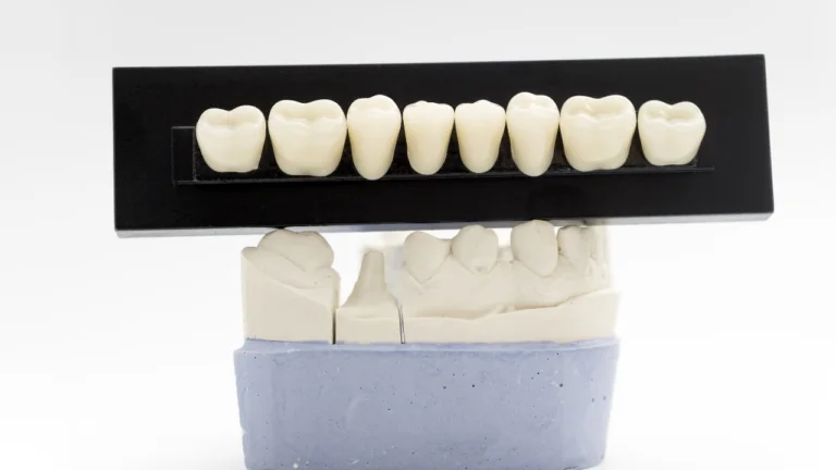 Zirconia Crowns: What the Material Does Well, and Where It Does Not