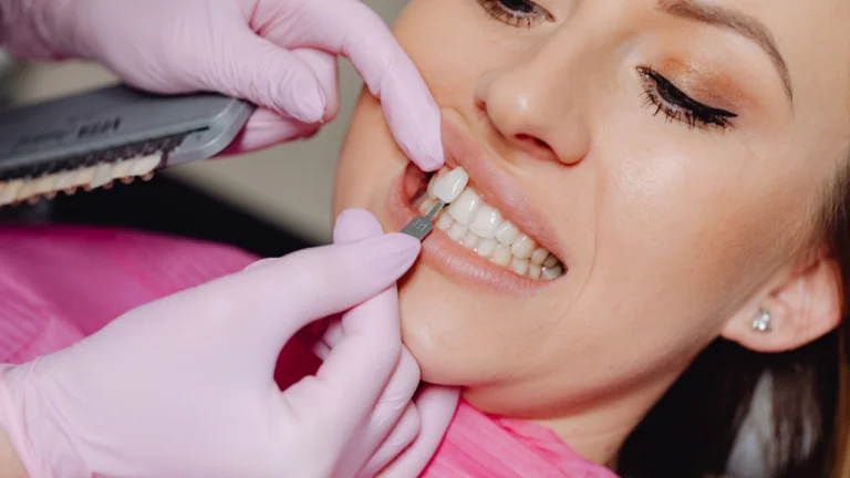 Hollywood Smile: What It Includes, and What It Cannot Fix